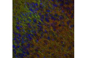 Indirect immunostaining of PFA fixed mouse brain section with anti-synaptogyrin 1 (dilution 1 : 500; red) and mouse anti-MAP 2 (cat. (Synaptogyrin 1 antibody)