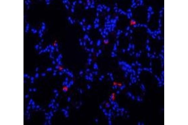 Mannose Receptor antibody