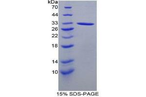 SDS-PAGE (SDS) image for Acid Phosphatase 5, Tartrate Resistant (ACP5) (AA 28-286) protein (His tag) (ABIN2123883) (ACP5 Protein (AA 28-286) (His tag))
