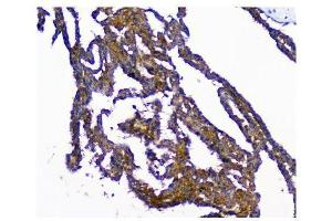 IHC analysis of NMI using anti-NMI antibody (ABIN3043451). (NMI antibody  (AA 2-307))