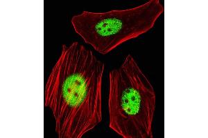 Fluorescent image of HeLa cells stained with AG Antibody (C-term) (ABIN1944739 and ABIN2838563). (AGAP4 antibody  (C-Term))