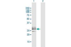 Western Blot analysis of CLEC9A expression in transfected 293T cell line by CLEC9A MaxPab polyclonal antibody. (CLEC9A antibody  (AA 1-241))