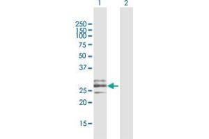 Western Blot analysis of CLEC9A expression in transfected 293T cell line by CLEC9A MaxPab polyclonal antibody.