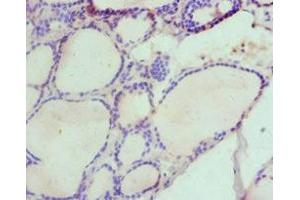 Immunohistochemistry of paraffin-embedded human thyroid tissue using ABIN7155960 at dilution of 1:100 (HAS3 antibody  (AA 339-553))