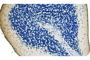 IHC analysis of Ankyrin Erythroid/ANK/ANK1 using anti-Ankyrin Erythroid/ANK/ANK1 antibody (ABIN7599959). (Erythrocyte Ankyrin antibody  (AA 1300-1844))