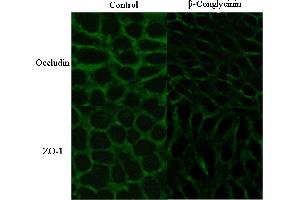 Immunofluorescence (Cultured Cells) (IF (cc)) image for anti-Tight Junction Protein 1 (TJP1) (AA 1551-1702) antibody (ABIN675024)
