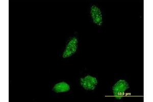 Immunofluorescence of purified MaxPab antibody to ICT1 on HeLa cell.