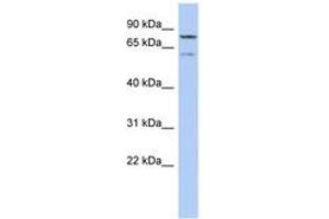 Image no. 1 for anti-Oxidative Stress Induced Growth Inhibitor 1 (OSGIN1) (AA 143-192) antibody (ABIN6743900) (OSGIN1 antibody  (AA 143-192))