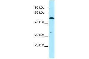 WB Suggested Anti-SPAM1 Antibody Titration: 1. (SPAM1 antibody  (C-Term))