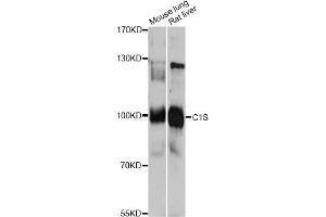 Western blot analysis of extracts of various cell lines, using C1S antibody. (C1S antibody)