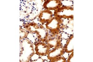 Immunohistochemistry (Paraffin-embedded Sections) (IHC (p)) image for anti-F-Box and Leucine-Rich Repeat Protein 17 (FBXL17) (AA 262-297), (C-Term), (Isoform 2) antibody (ABIN1944744)