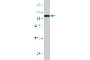 Western Blot detection against Immunogen (62. (DCPS antibody  (AA 1-337))