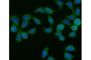 IF analysis of GLB1/Beta-galactosidase using anti-GLB1/Beta-galactosidase antibody (ABIN7601806).