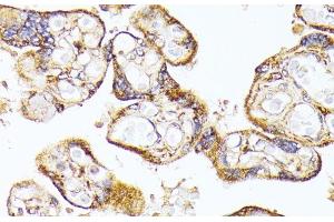 Immunohistochemistry of paraffin-embedded Human placenta using VEGF Receptor 1 Polyclonal Antibody at dilution of 1:100 (40x lens). (FLT1 antibody)