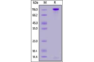 Human PTPRD, His Tag on  under reducing (R) condition. (PTPRD Protein (AA 21-1265) (His tag))