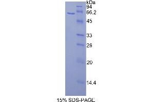 SDS-PAGE (SDS) image for Calbindin (CALB1) (AA 3-261) protein (His tag,GST tag) (ABIN2122540)
