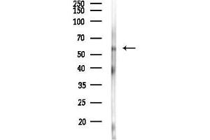 Western blot analysis of lysates from Rat liver, using Phospho-Lck (Ser59) Antibody at 1/1000 dilution.