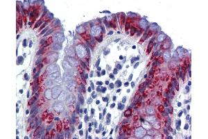 Immunohistochemistry (IHC) image for anti-Anterior Gradient Homolog 2 (Xenopus Laevis) (AGR2) (Middle Region) antibody (ABIN2775338) (AGR2 antibody  (Middle Region))