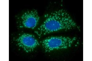 ICC/IF analysis of PDKZ1 in Hep3B cells line, stained with DAPI (Blue) for nucleus staining and monoclonal anti-human PDKZ1 antibody (1:100) with goat anti-mouse IgG-Alexa fluor 488 conjugate (Green). (PDZK1 antibody)