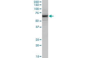 GATAD2B polyclonal antibody (A01), Lot # 051114JC01. (GATAD2B antibody  (AA 3-110))