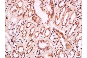Formalin-fixed and paraffin embedded human kidney labeled with Anti-MELK/HPK38 Polyclonal Antibody, Unconjugated  at 1:200 followed by conjugation to the secondary antibody and DAB staining. (MELK antibody  (AA 101-250))
