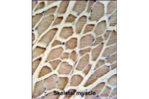 GBAS Antibody (Center) (ABIN652238 and ABIN2840994) IHC analysis in formalin fixed and paraffin embedded skeletal muscle followed by peroxidase conjugation of the secondary antibody and DAB staining. (GBAS antibody  (AA 130-159))