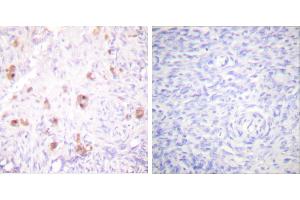 P-peptide - +Immunohistochemical analysis of paraffin-embedded human ovary tissue using IKK-γ (Phospho-Ser31) Antibody (#A0443).