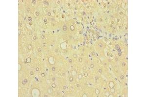 Immunohistochemistry of paraffin-embedded human liver tissue using ABIN7170745 at dilution of 1:100 (SAMD7 antibody  (AA 1-300))