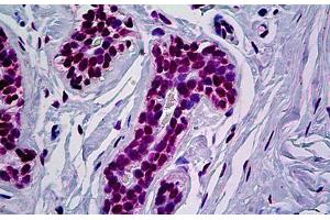 Human Breast: Formalin-Fixed, Paraffin-Embedded (FFPE) (RUNX1 antibody  (AA 210-311))