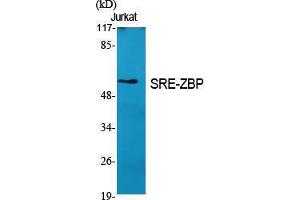 Western Blotting (WB) image for anti-Zinc Finger Protein 187 (ZNF187) (Internal Region) antibody (ABIN3187053) (ZNF187 antibody  (Internal Region))