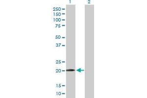 Western Blot analysis of WWOX expression in transfected 293T cell line by WWOX MaxPab polyclonal antibody. (WWOX antibody  (AA 1-189))