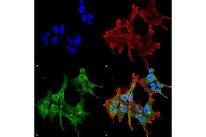 Immunocytochemistry/Immunofluorescence analysis using Mouse Anti-Piccolo Monoclonal Antibody, Clone 6H9-B6 (ABIN863104 and ABIN863105). (Piccolo antibody)