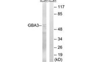 Western blot analysis of extracts from HuvEc cells, using GBA3 Antibody. (GBA3 antibody  (AA 291-340))