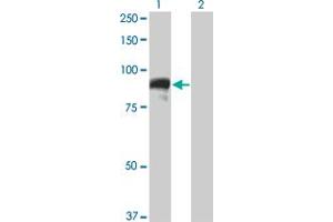 Western Blot analysis of TOP3B expression in transfected 293T cell line by TOP3B monoclonal antibody (M05), clone 4H7. (TOP3B antibody  (AA 1-862))