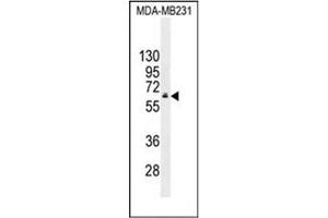 Western blot analysis of HNF1 beta / TCF2 Antibody (C-term) in MDA-MB231 cell line lysates (35ug/lane).