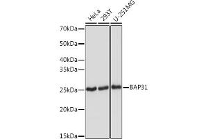 Western blot analysis of extracts of various cell lines, using B Rabbit mAb (ABIN1680181, ABIN7101458, ABIN7101459 and ABIN7101460) at 1:1000 dilution. (BCAP31 antibody)