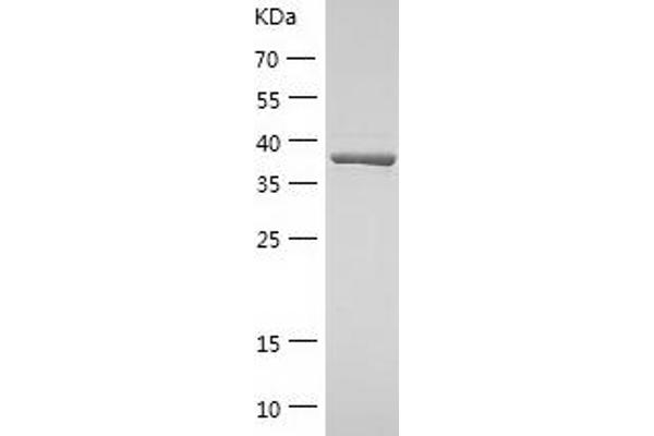 CYR61 Protein (AA 25-381) (His tag)