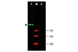 Image no. 1 for anti-GLI Family Zinc Finger 2 (GLI2) (Internal Region) antibody (ABIN401282) (GLI2 antibody  (Internal Region))