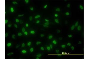 Immunofluorescence of monoclonal antibody to TOP2A on HeLa cell. (Topoisomerase II alpha antibody  (AA 1435-1531))