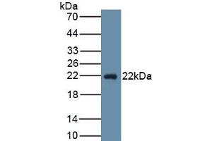 Detection of Recombinant PGD2S, Human using Monoclonal Antibody to Prostaglandin-H2 D-isomerase (PTGDS) (PTGDS antibody  (AA 32-190))