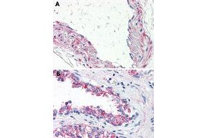 Immunohistochemical staining of formalin-fixed, paraffin-embedded human vessel (A) and human prostate (B) tissue after heat-induced antigen retrieval. (5HT1B Receptor antibody  (Internal Region))