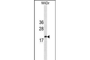 IFNA5 Antibody (C-term) (ABIN1536762 and ABIN2849940) western blot analysis in WiDr cell line lysates (35 μg/lane). (IFNA5 antibody  (C-Term))