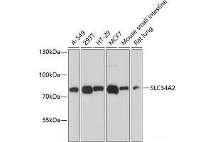 Western blot analysis of extracts of various cell lines using SLC34A2 Polyclonal Antibody at dilution of 1:3000. (SLC34A2 antibody)