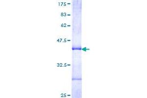 CYP2J2 Protein (AA 408-498) (GST tag)