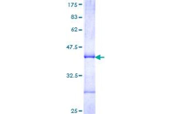 CYP2J2 Protein (AA 408-498) (GST tag)