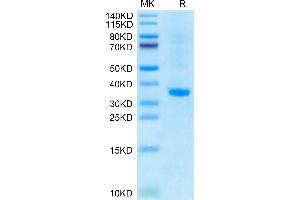 SFRP2 Protein (AA 25-295) (His tag)