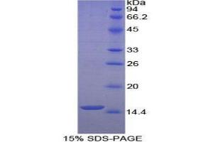 SDS-PAGE (SDS) image for Histatin 1 (HTN1) (AA 20-57) protein (His tag) (ABIN1079874) (HTN1 Protein (AA 20-57) (His tag))