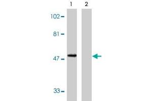 Western blot analysis using CX3CR1 polyclonal antibody at 1 ug/mL on human spleen lysate in the absence (lane 1) and presence (lane 2) of specific blocking peptide. (CX3CR1 antibody  (AA 2-21))