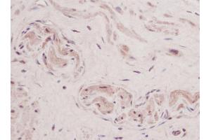 Formalin-Fixed, Paraffin-Embedded Human Sections prostate stained with TSLP Antibody Cat. (Thymic Stromal Lymphopoietin antibody)