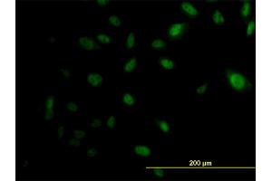 Immunofluorescence of monoclonal antibody to EP300 on HeLa cell. (p300 antibody  (AA 731-830))
